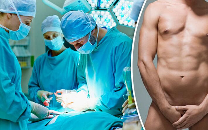 Surgical increase in the penis