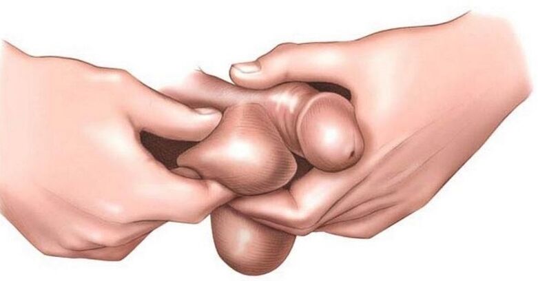 why do men's balls itch